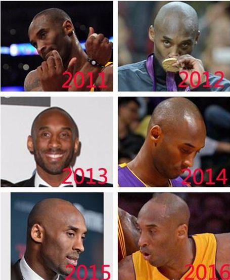 為什么nba球員容易掉頭發（打球會脫發？NBA3大巨星的脫發之路：一圖看詹姆斯發際線的變化 ）